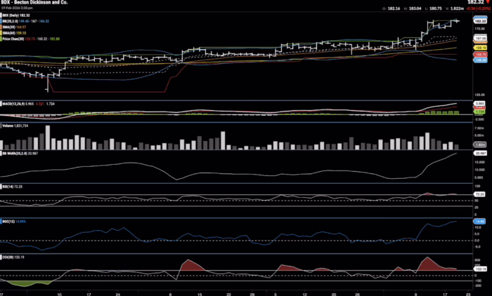 Chart Advisor: A Complete Understanding of Price Action